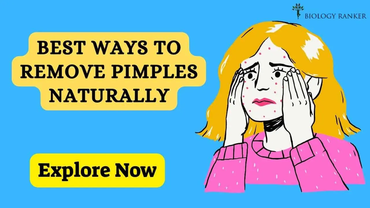 How To Remove Pimples Naturally And Permanently