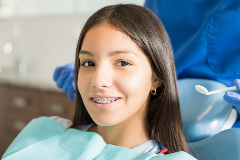 Beyond Aesthetics How Braces Contribute to Long-Term Oral Health