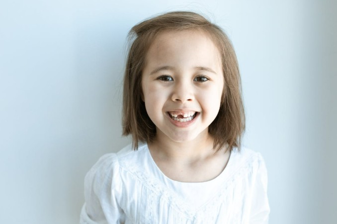 What are the Best Solutions for Missing Front Teeth?