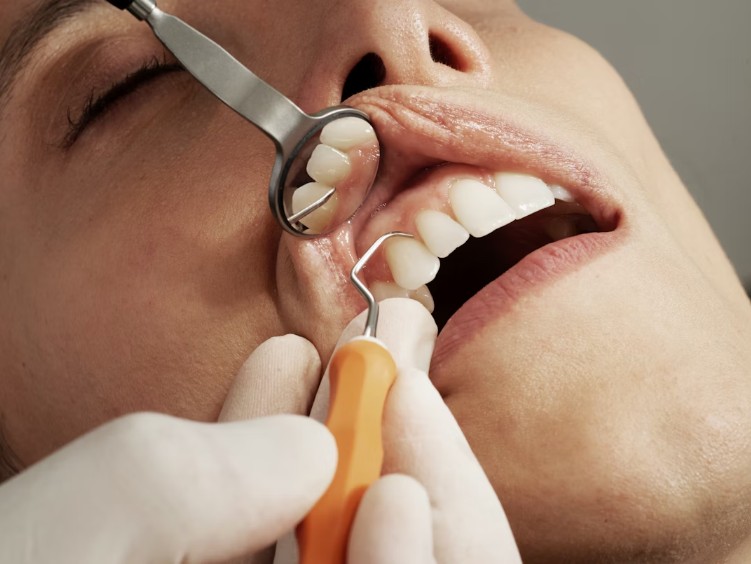 Correcting Minor Imperfections with Cosmetic Dental Procedures